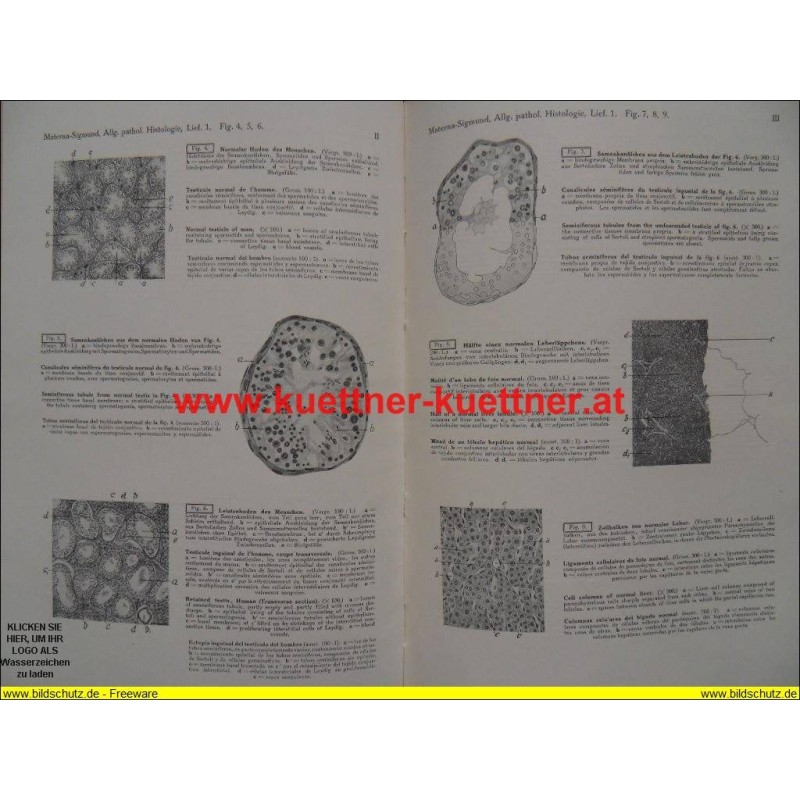 Allgemeine pathologische Histologie des Menschen.  Lfg. 1 (1927)